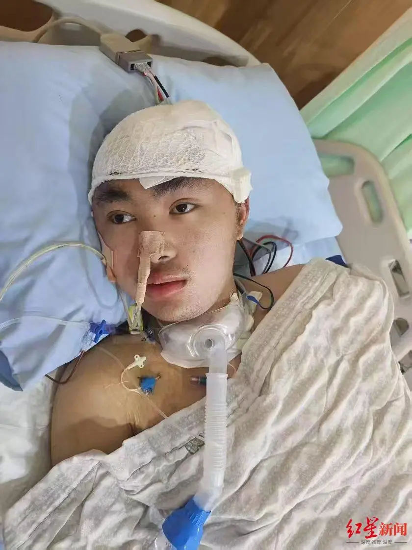 23岁研究生被少年无证驾车撞成重伤后心智如幼童