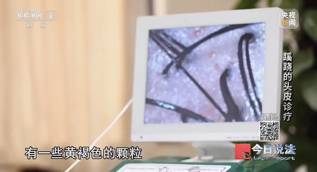 洗个头花2万元!浙江警方破获特大美发诈骗案